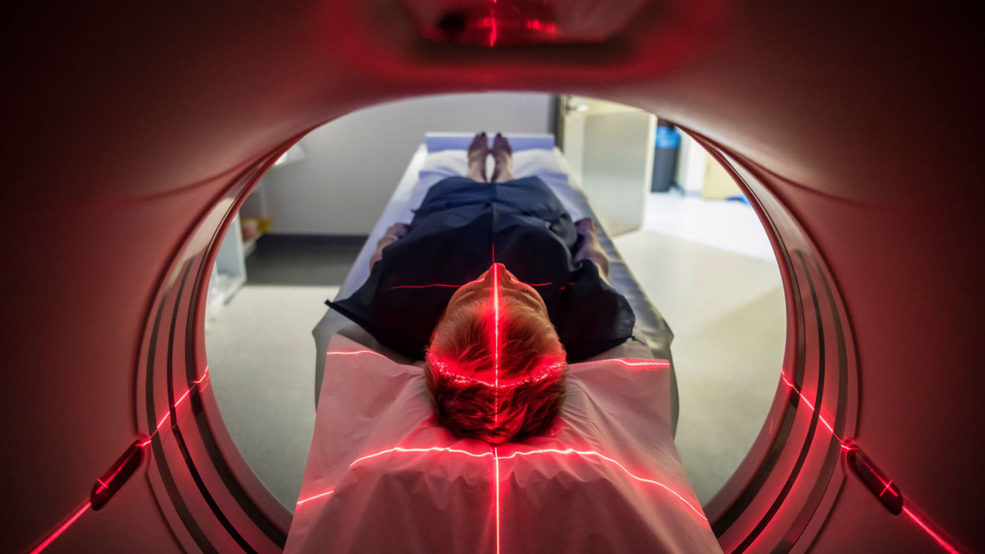 PSMA und FDG PET-CT | radiomed PET-CT Rhein-Main